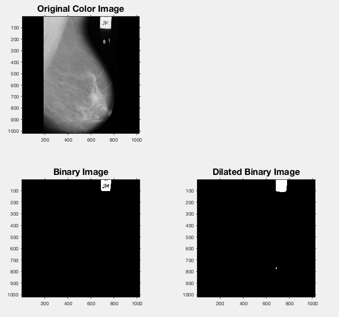 Binarise image